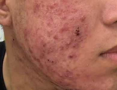 Những làn da này nhất định nên phục hồi với Cốt Đông Y 08